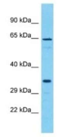 OR51I2 Rabbit anti-Human, Polyclonal, Novus Biologicals 100 &mu;g; Unconjugated:Antibodies,